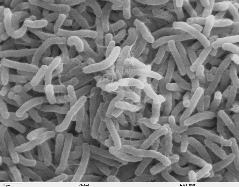 Mikroskopische Aufnahme von Cholera-Bakterien