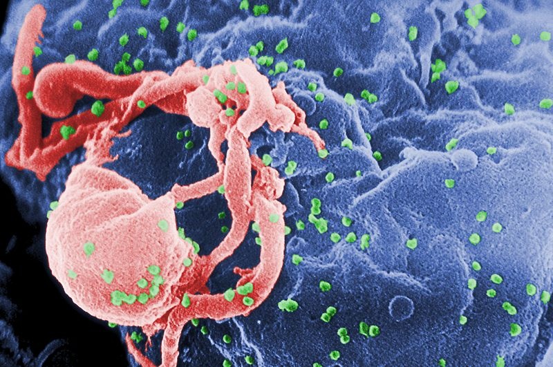 Bild: United States Department of Health and Human Services/Public Domain HIV-Viren (grün) knospen auf Lymphocyten