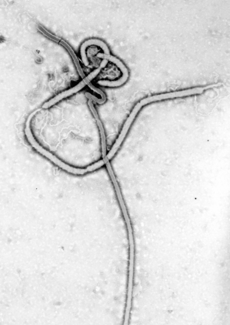 Bild: Centers for Disease Control and Prevention's Public Health Image Library/Public Domain